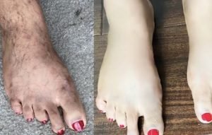 Hand & Feet Treatment Sets
