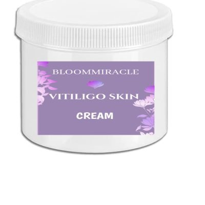 DEPIGMENTED - VITILIGO SKIN Cream