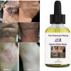 Ingrown Hair & Razor Bump Removal Oil